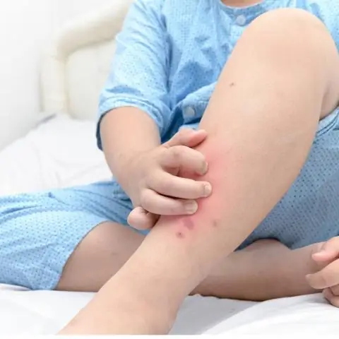 Постельных клопов привлекает грязное белье