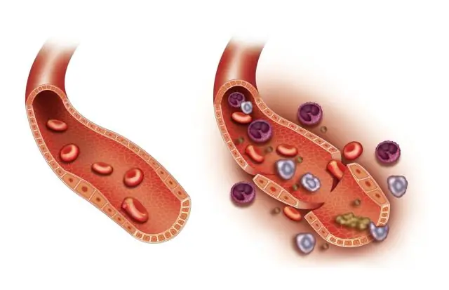 Хищные бактерии, которые проделывают «иллюминаторы» и рисуют «фрески» из вредоносных бактерий