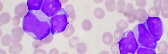 Исследование паразитов прокладывает путь к терапии для борьбы со смертельными инфекциями