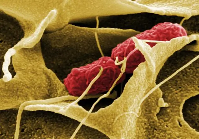 Молекулярный мусоропровод играет роль в упаковке генома