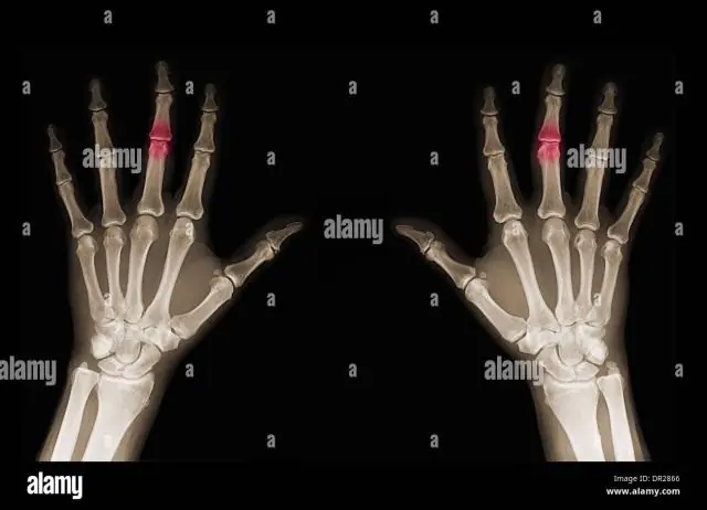 Рентгенограммы скелета Долли не показывают признаков аномального остеоартрита