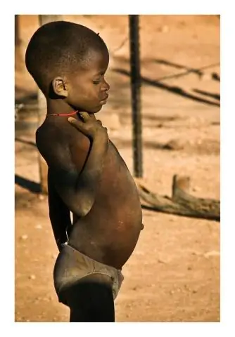 Вырубка лесов в Африке не так велика, как опасались