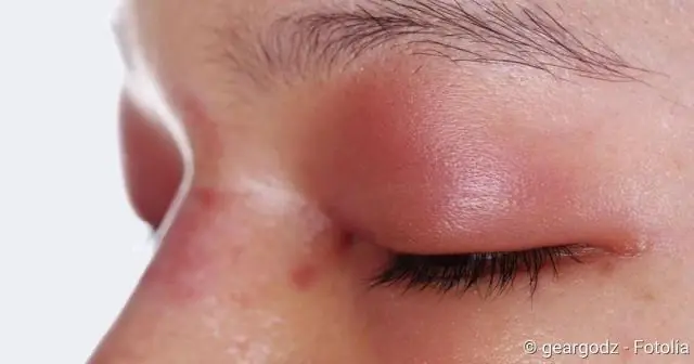 Суперзаряженные антибиотики могут переломить ситуацию в борьбе с супербактериями