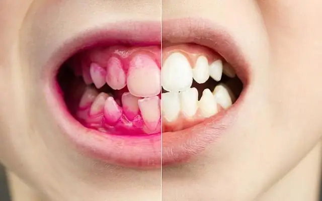 Как хорошие бактерии контролируют ваши гены: химические сигналы от кишечных бактерий влияют на регуляцию генов в слизистой оболочке кишечника