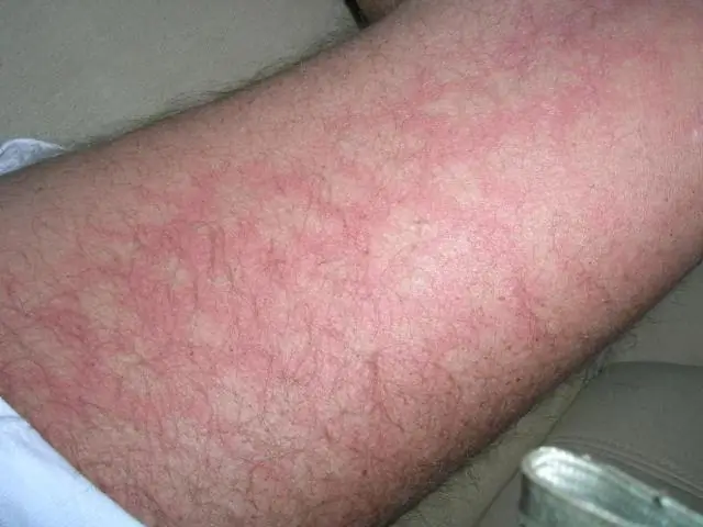 Пятнистый охват: климатические модели недооценивают охлаждающий эффект суточного цикла облачности