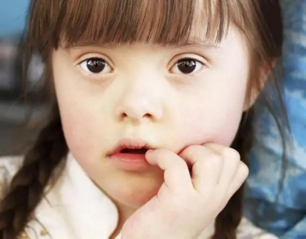 Подсчет хромосом: ученые-растения разгадывают вековую тайну размножения