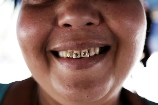 Небольшие золотые прииски в Сенегале создают высокое загрязнение ртутью: уровни ртути часто в десять раз превышают международные стандарты