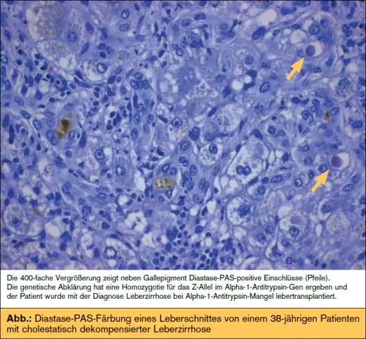 Генетические ограничения угрожают нуту, всемирно важному продукту питания: новое исследование показывает перспективы улучшения урожая с использованием диких родственников