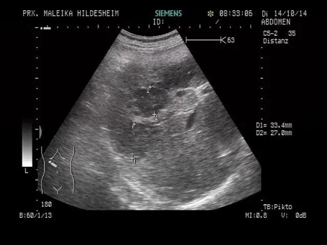 Обнаружение, система отпугивания поможет орлам, ветряные турбины лучше сосуществуют