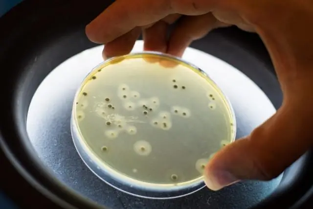 Staphylococcus aureus: новый механизм вирулентности и устойчивости к антибиотикам