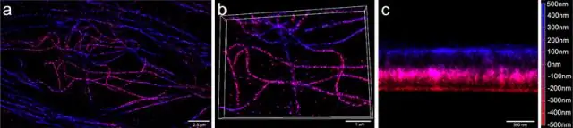 Клеточная биология: динамика микротрубочек