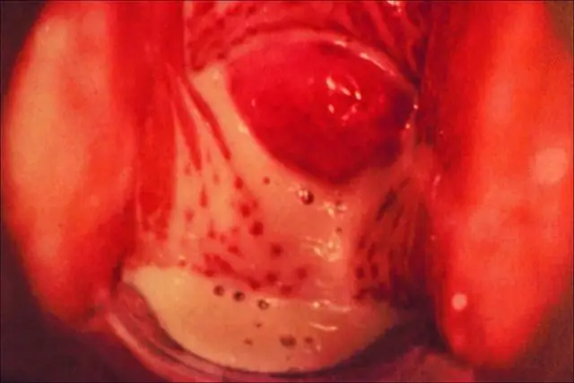 Трихомоноз обнаружен у птиц майна в Пакистане