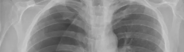 Генетический алгоритм предсказывает вертикальный рост городов