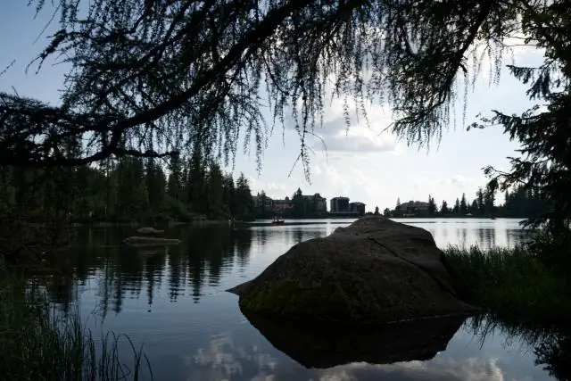 Новый способ определить, чем питаются микробы