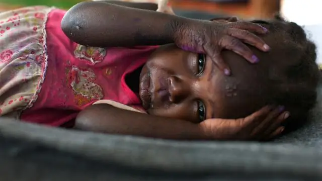 Воздействие вируса денге на Эфиопию