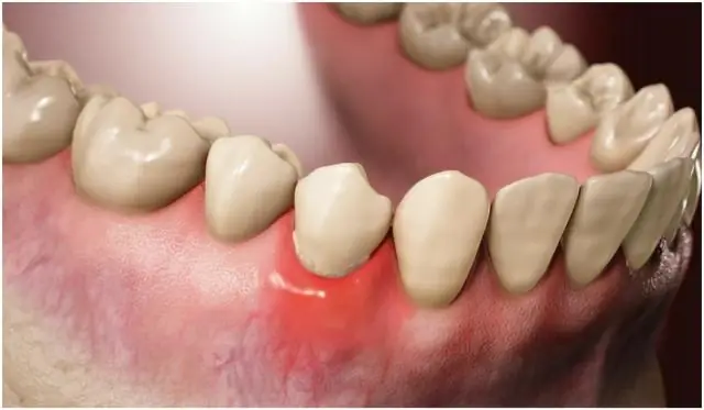 Изменение генетического кода бактерий обещает создание лекарств более длительного действия