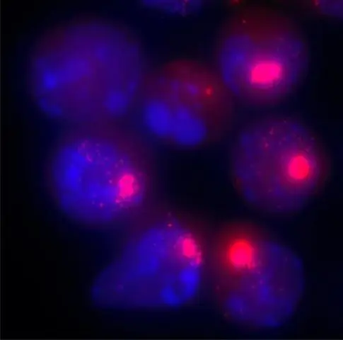 Структурный белок, необходимый для инактивации Х-хромосомы: SMCHD1 необходим для того, чтобы хромосома приняла конформацию, которая подавляет экспрессию генов