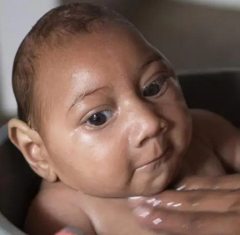 Калифорнийские комары Aedes, способные распространять вирус Зика