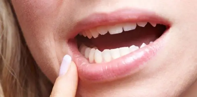 Исследование генов выявило связь супербактерий между людьми и животными