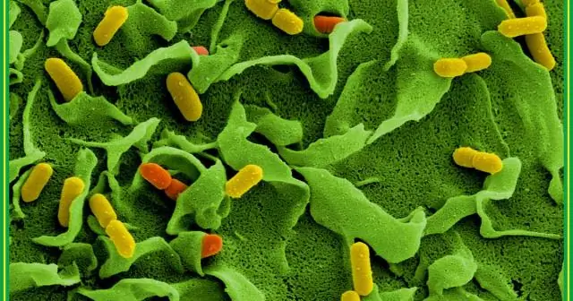 Опасный патоген пищевого происхождения, связанный с многоножками