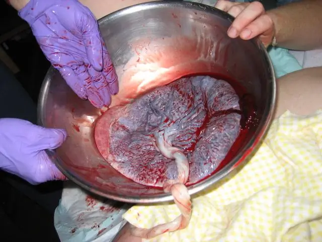 Плацентарный барьер на чипе может привести к лучшему пониманию преждевременных родов