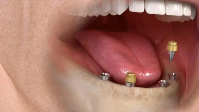 Морским млекопитающим не хватает функционального гена для защиты от популярных пестицидов