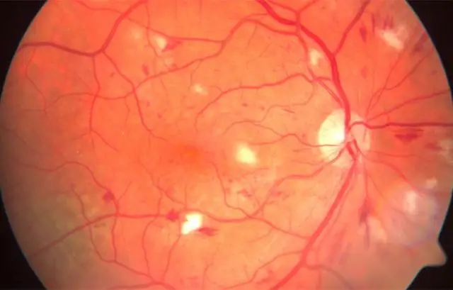 Как защитить дрожжи от повреждений при производстве биотоплива