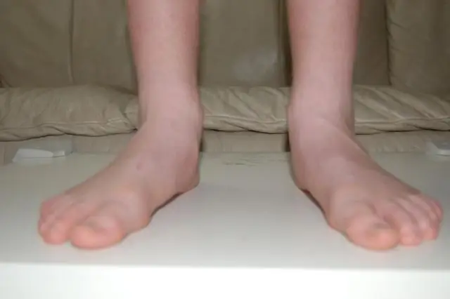 Общий предковый ген вызывает сегментацию тела у пауков и насекомых