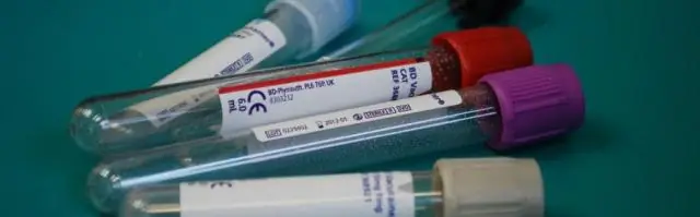 Тест может выявить пациентов, подверженных риску заражения смертельными грибковыми спорами