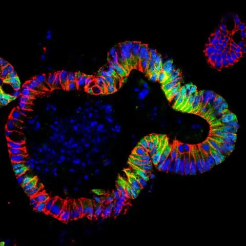 Как молекулярный сигнал помогает растительным клеткам решать, когда производить масло: детали механизма предлагают новую стратегию инженерии растений для производства большего количества масла