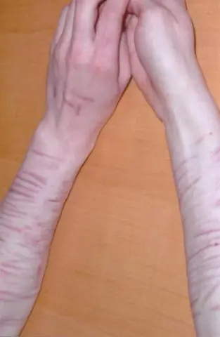 С возрастом кожа заживает с меньшим количеством рубцов, и теперь исследователи знают, почему