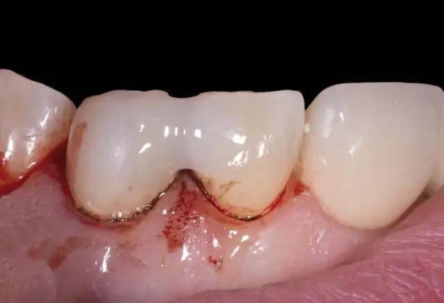 Улучшение реконструкции палеотемпературы: швейцарские озера как модельная система