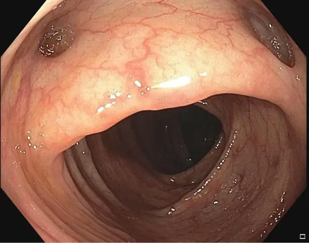 Самый плотный неаминогликозидный лиганд для А-сайта бактериальной рибосомной РНК
