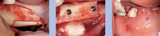 Мягкие ткани показывают, что юрский ихтиозавр был теплокровным, имел подкожный жир и камуфляж