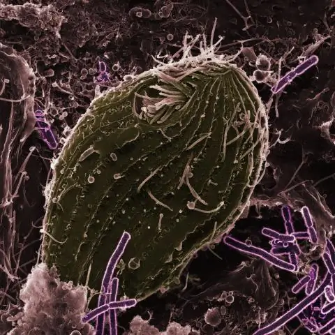 Двойной стресс замедляет эволюцию: бактерии медленнее вырабатывают устойчивость к антибиотикам, если им также приходится защищаться от хищников