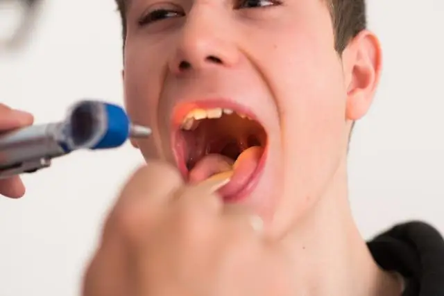 Новый вид змей обнаружен в желудке хищной змеи