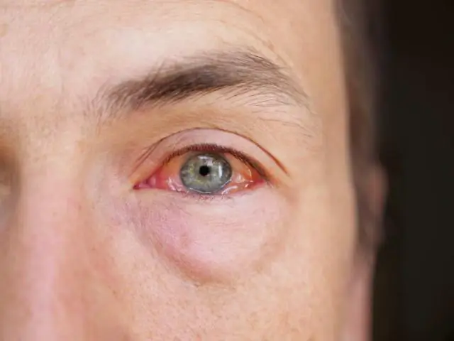 Теплая вода и химическое воздействие влияют на экспрессию генов в разных поколениях прибрежной рыбы