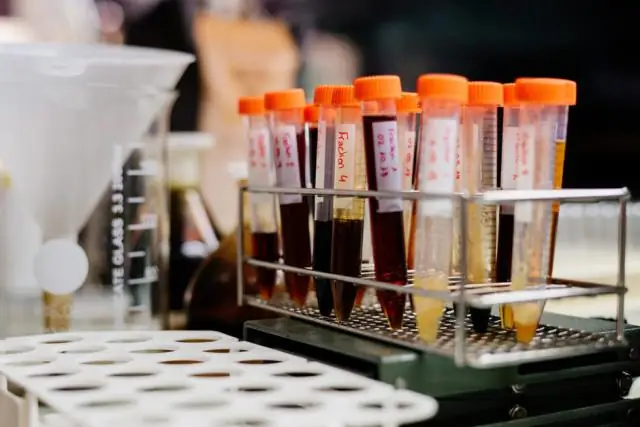 Химические вещества, разрушающие эндокринную систему, связаны с метаболическим синдромом у лошадей, показывают исследования