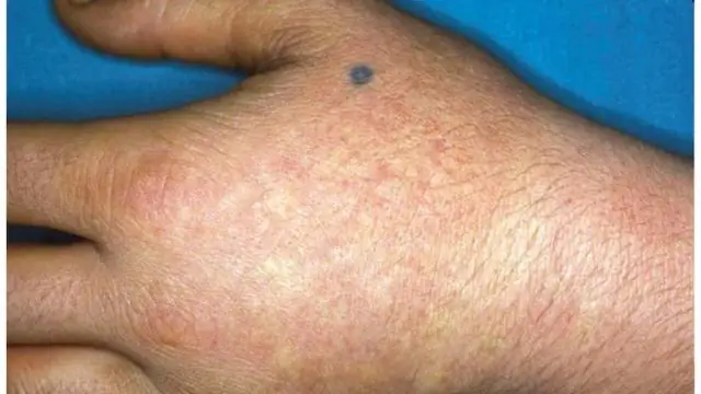 Клеточные редакторы исправляют генетические ошибки