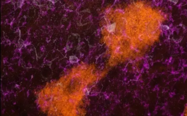 Мышь TIGER дебютирует в качестве модели неврологических заболеваний