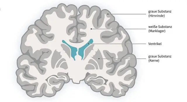 Число бабочек сократилось на две трети, обнаружили немецкие ученые: высокоинтенсивное сельское хозяйство сокращает количество видов бабочек в прилегающих районах