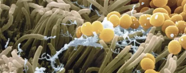 Бактерии выжидают, когда антибиотики атакуют: исследование предлагает стратегии для лучшей дозировки для борьбы с инфекциями