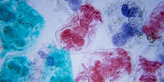 Дети пожилых матерей более восприимчивы к мерам старения