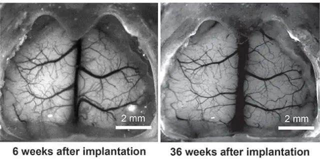 Напечатанный на 3D-принтере прозрачный череп открывает окно в мозг: устройство может дать новую информацию для исследования мозга при сотрясениях мозга, болезни Альцгеймера и Паркинсона