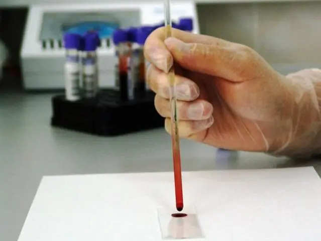 Новый подход к глубокому обучению предсказывает структуру белка по аминокислотной последовательности