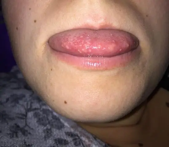 Электрический язык может справиться с более острой пищей, чем вы