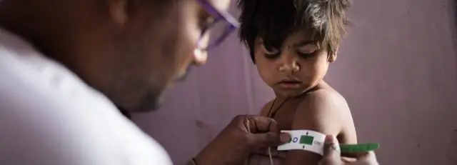 Лекарства растений времен Гражданской войны уничтожают лекарственно-устойчивые бактерии в лабораторных тестах: полевые госпитали Конфедерации обратились к традиционным средствам в условиях блокады Сою