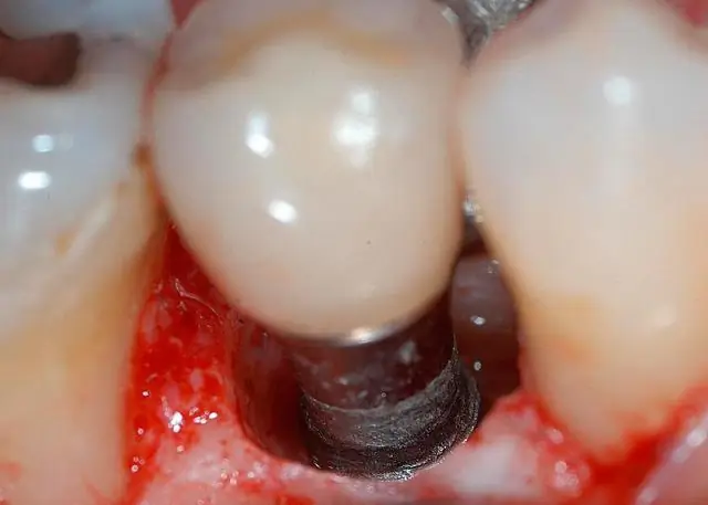 Безболезненно благодаря эволюции