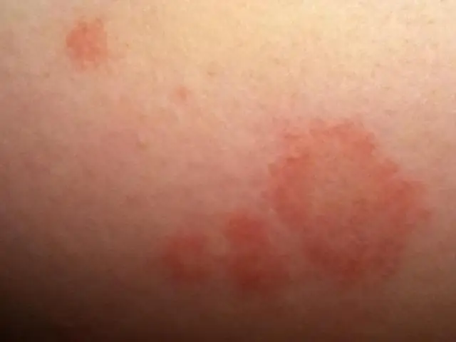 Эволюция глаз щенка