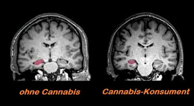 Воздействие выборочных рубок на малонарушенные лесные ландшафты Конго